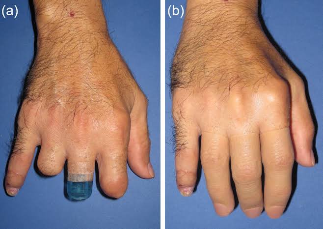 Cosmatic Hand Image