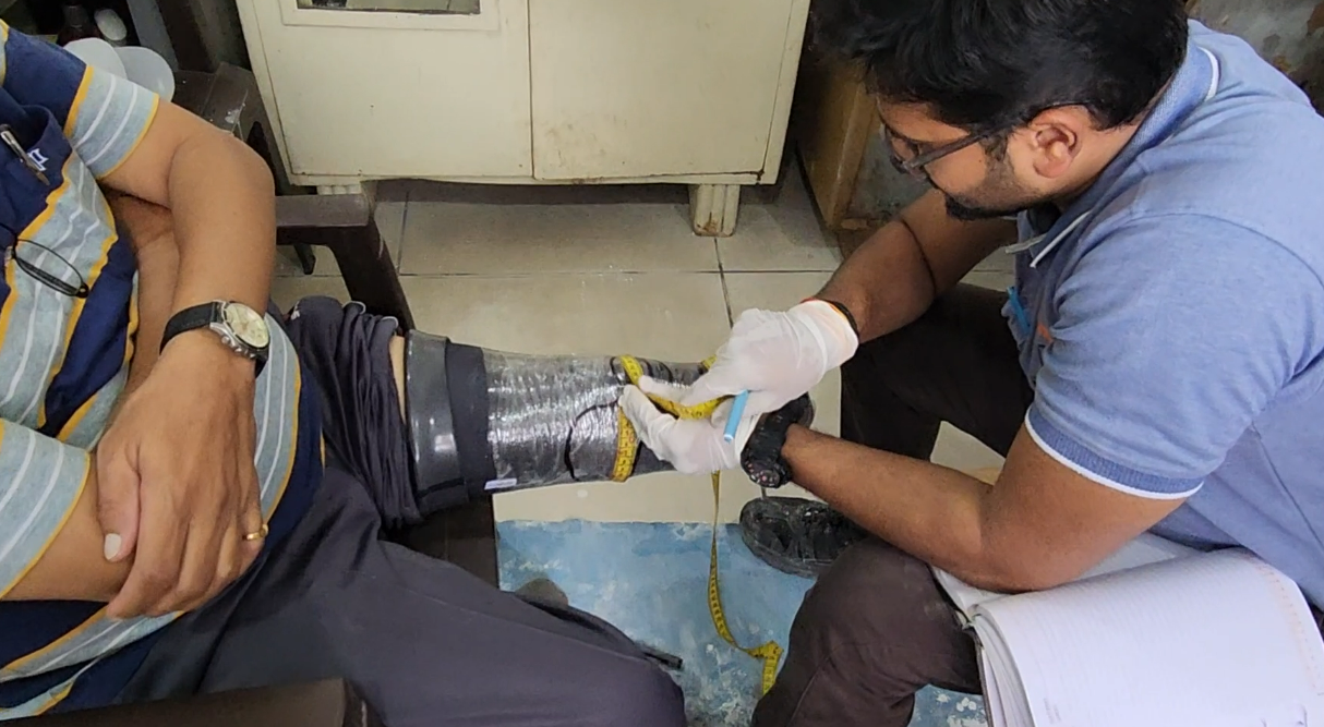 Image of Mr. Utsav Basutkar while taking the measurement of limb volume