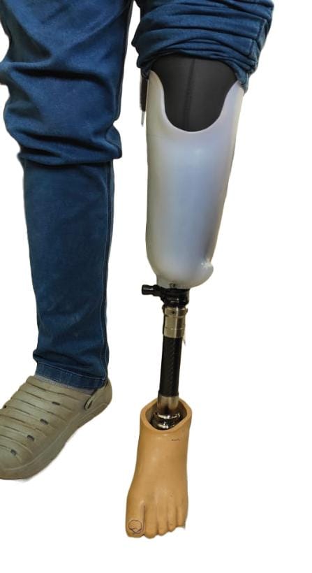 Image of a patient who is balancing his weight using a prosthetic leg